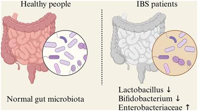 Gut microbiota and irritable bowel syndrome: status and prospect